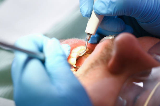 Best Emergency Gum Treatment in Ettrick, VA