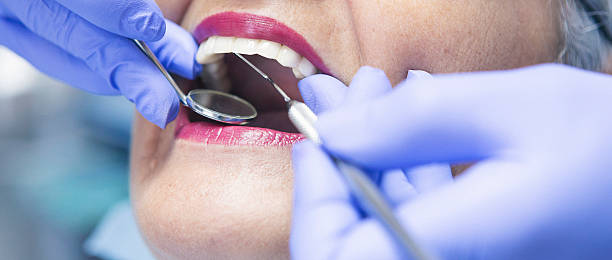 Best Emergency Dental Care for Broken or Chipped Teeth in Ettrick, VA